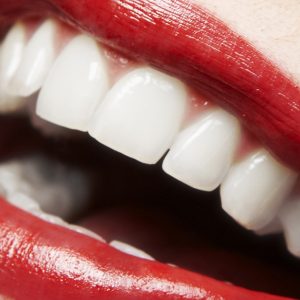 Dental Check-Up With Optional Stain Removal, Or Laser Teeth Whitening DENTISTRY Shop Online at Special Price from Dubai Offers